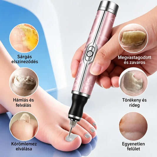 💅👍Elektromos körömreszelő onychomycosis kezelésére