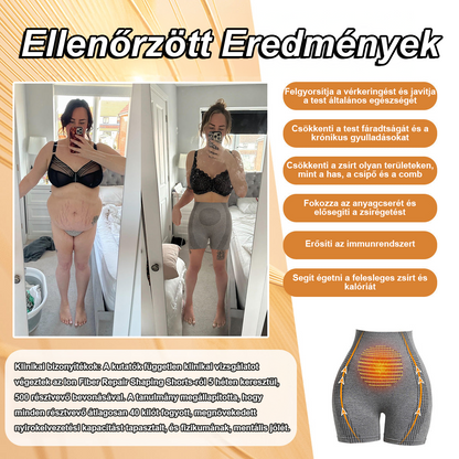 【🩷Utánvétes fizetés (COD) 🩷】 2025 Baicloud™ Mikrovibrációs masszázsmodul Ionizált szálakkal ellátott selyemnadrág, amely regenerálja és formázza a bőrt 🥰