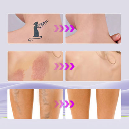 🔥 Az akció utolsó napján ajándékba adunk egy kefét! ! 💥 Vízálló, könnyű alapozó tökéletes fedéssel