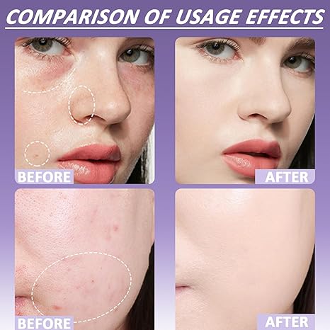 🔥 Vásárolj egyet, a másodikat ingyen kapod! 🎁 Puha, matt krémes korrektor