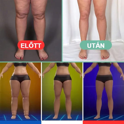 🔥Elektronikus limfavizeletű és cellulitisellenes masszírozó eszköz