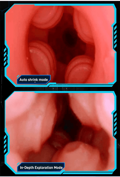 🔥【Bizalmas kézbesítés】🔥 Merüljön el az örömben a Champion Trainerrel! -- ⏰Luxurysal 2025 legújabb legfelsőbb sorozata