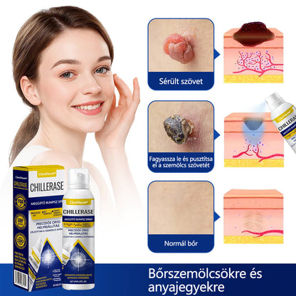 CleraNaure® ChillErase dudorjavító spray