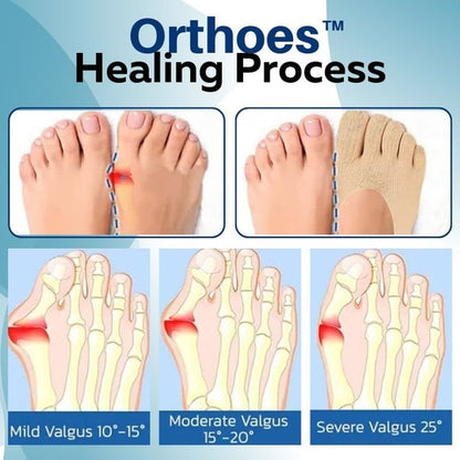 Orthoes™ ortopéd zoknik