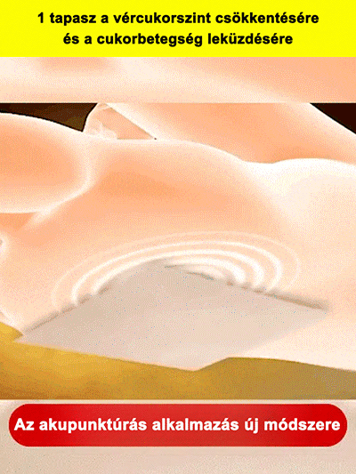 Vércukorszint-csökkentő akupunktúrás mágneses tapasz