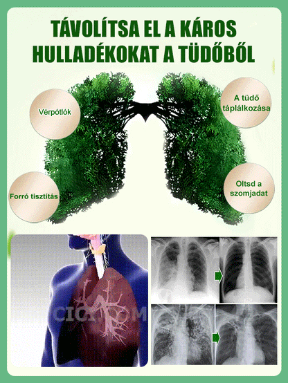 【Szárazságtűrő mérgekirály】Platina-gyémánt-zöld hercegnő nagy levelű cserepes növény