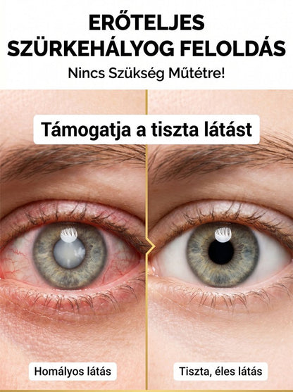 Homoktövismag-olaj szemvédő lágyzselatin kapszula