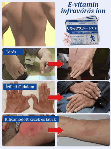 Glükózamin-kondroitin elasztikus hideg borogatás