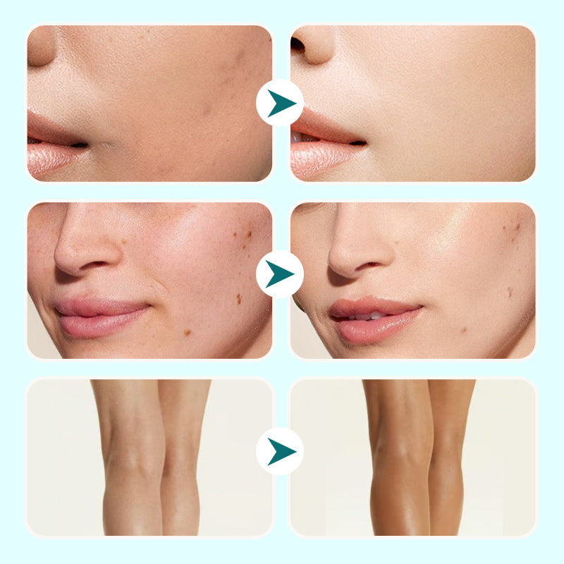 💕Korlátozott ideig 50% kedvezmény💕Női hidratáló vízálló korrektor krém